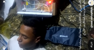 طالب في كلية التكنولوجيا الحديثة يبتكر جهاز لعلاج الشخير