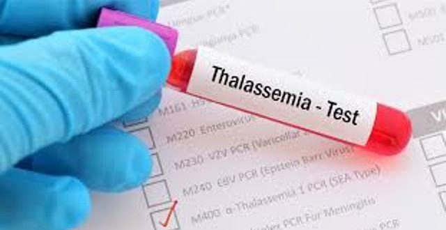 كلية الجزيرة تدشن حملة التبرع بالدم لمرضى الثلاسيميا