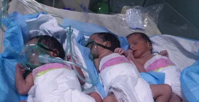 ولادة توائم بمستشفى فلسطين